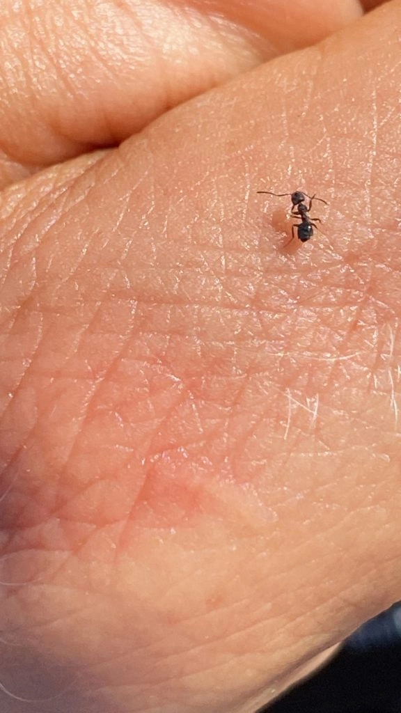 Ant on a persons hand