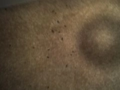 bed bug treatment 4